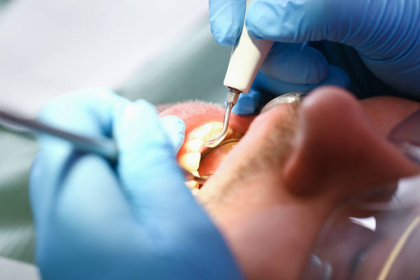 Best Urgent Care for Lost Fillings or Crowns in Portage, IN