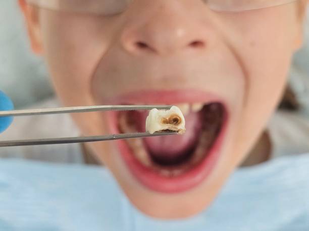 Best Cosmetic Emergency Dentistry in Portage, IN